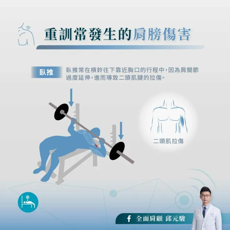 重訓 肩膀受傷 二頭肌拉傷