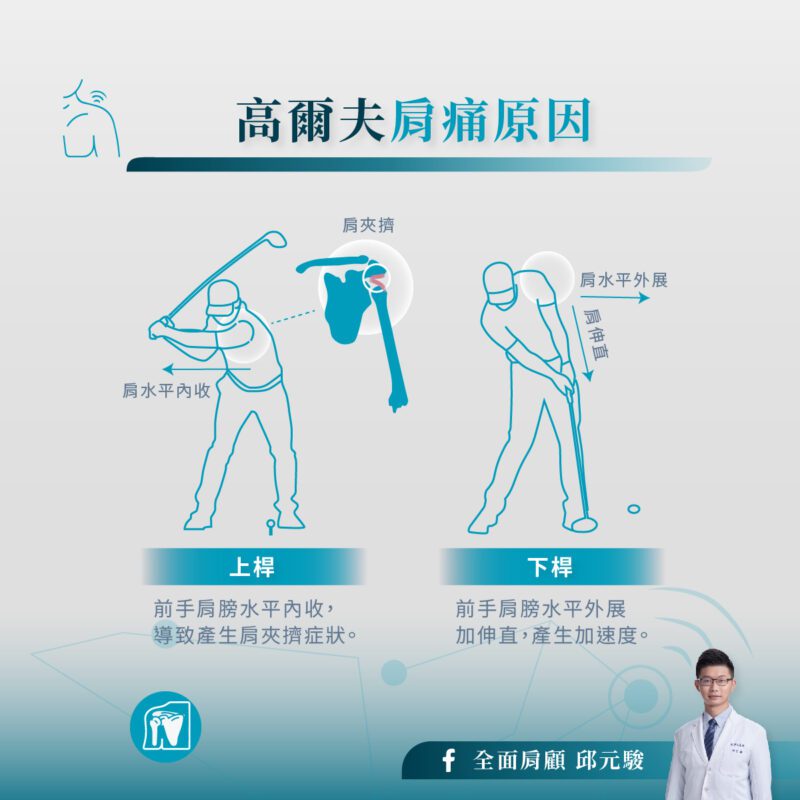 高爾夫球 肩痛原因