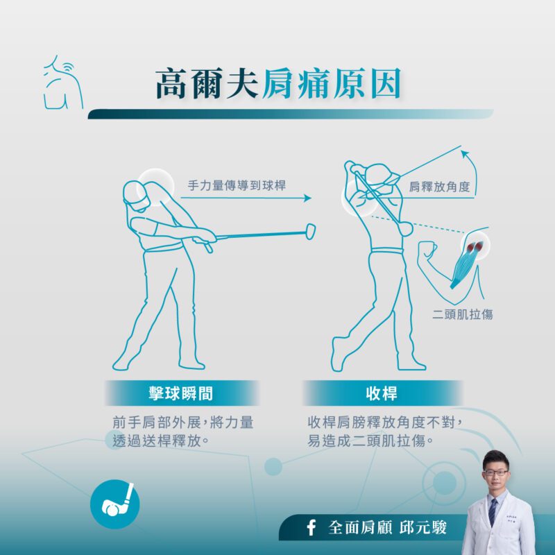 高爾夫球 擊球肩痛原因