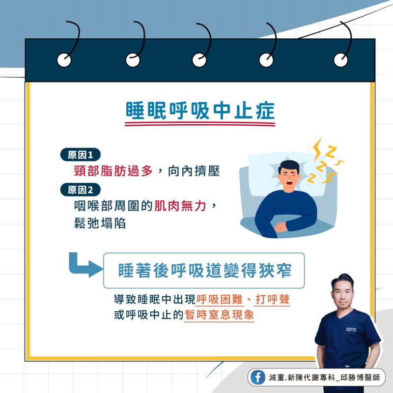 睡眠呼吸中止症 原因 症狀