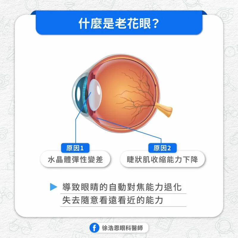 老花眼 原因