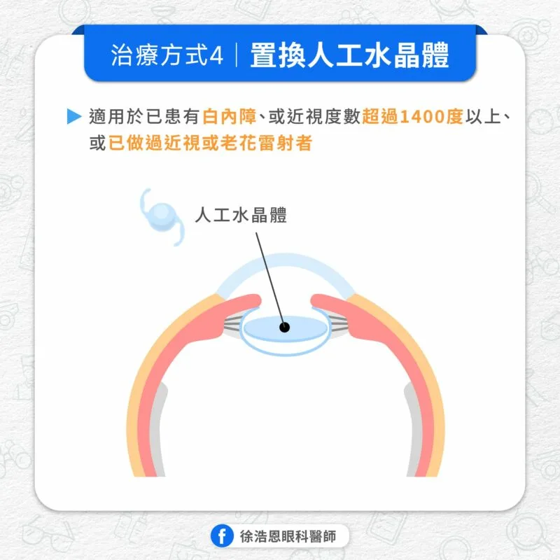 老花眼 置換人工水晶體