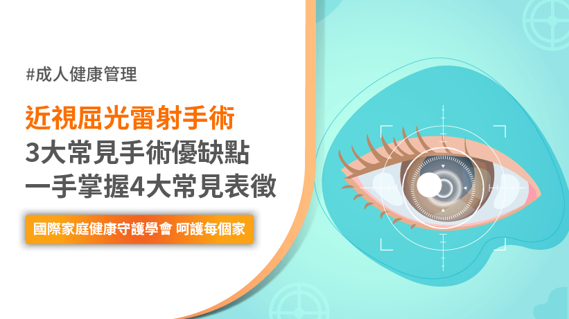 近視屈光雷射手術全解析:3大常見手術優缺點一手掌握